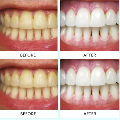 Teeth Whitening Strips (box2)