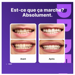 Teeth Whitening Strips (box2)