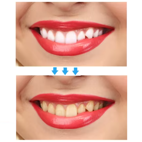 Teeth Whitening Strips (box2)