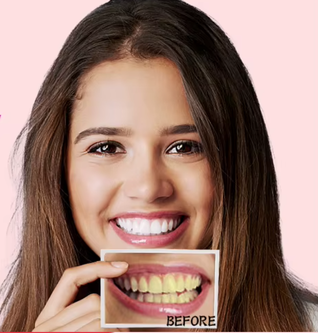 Teeth Whitening Strips (box2)