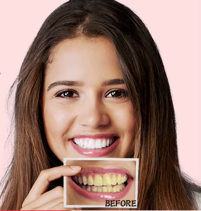 Teeth Whitening Strips (box2)