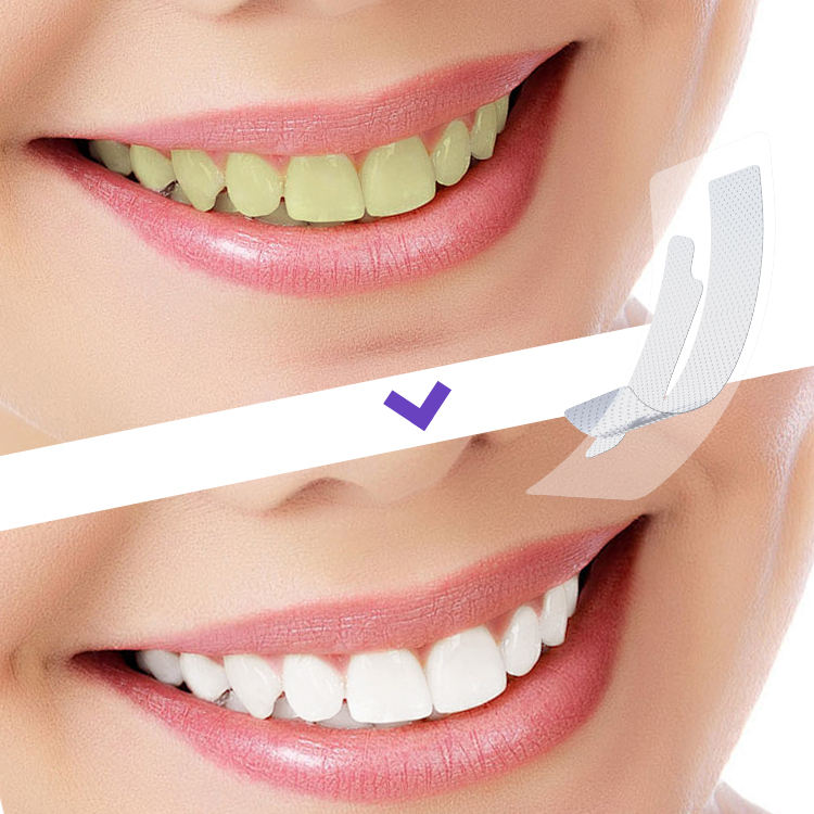Teeth Whitening Strips (box2)
